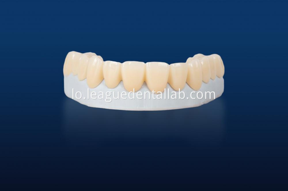 zirconia ເຕັມ Full zirconia